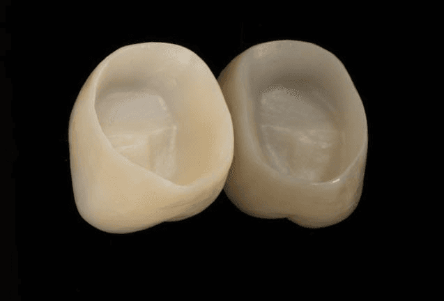 Zirconia Crown