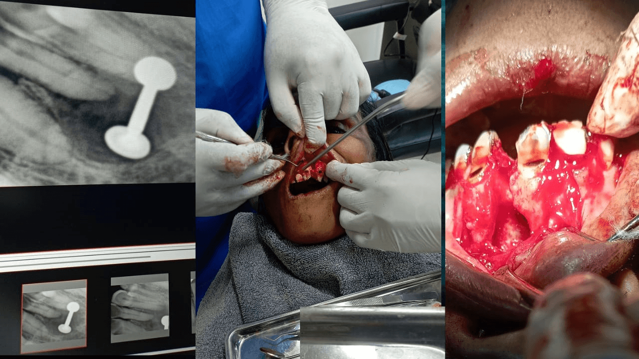 Cyst And Tumor Surgery