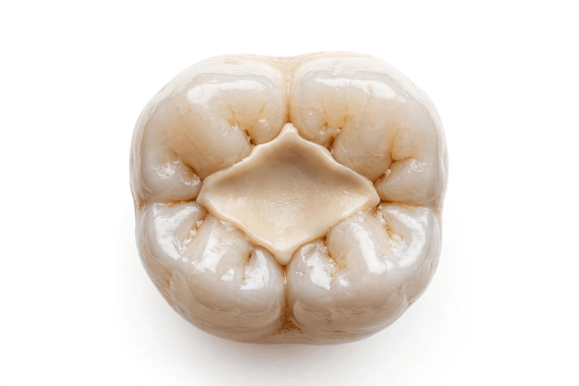 Dental Filling