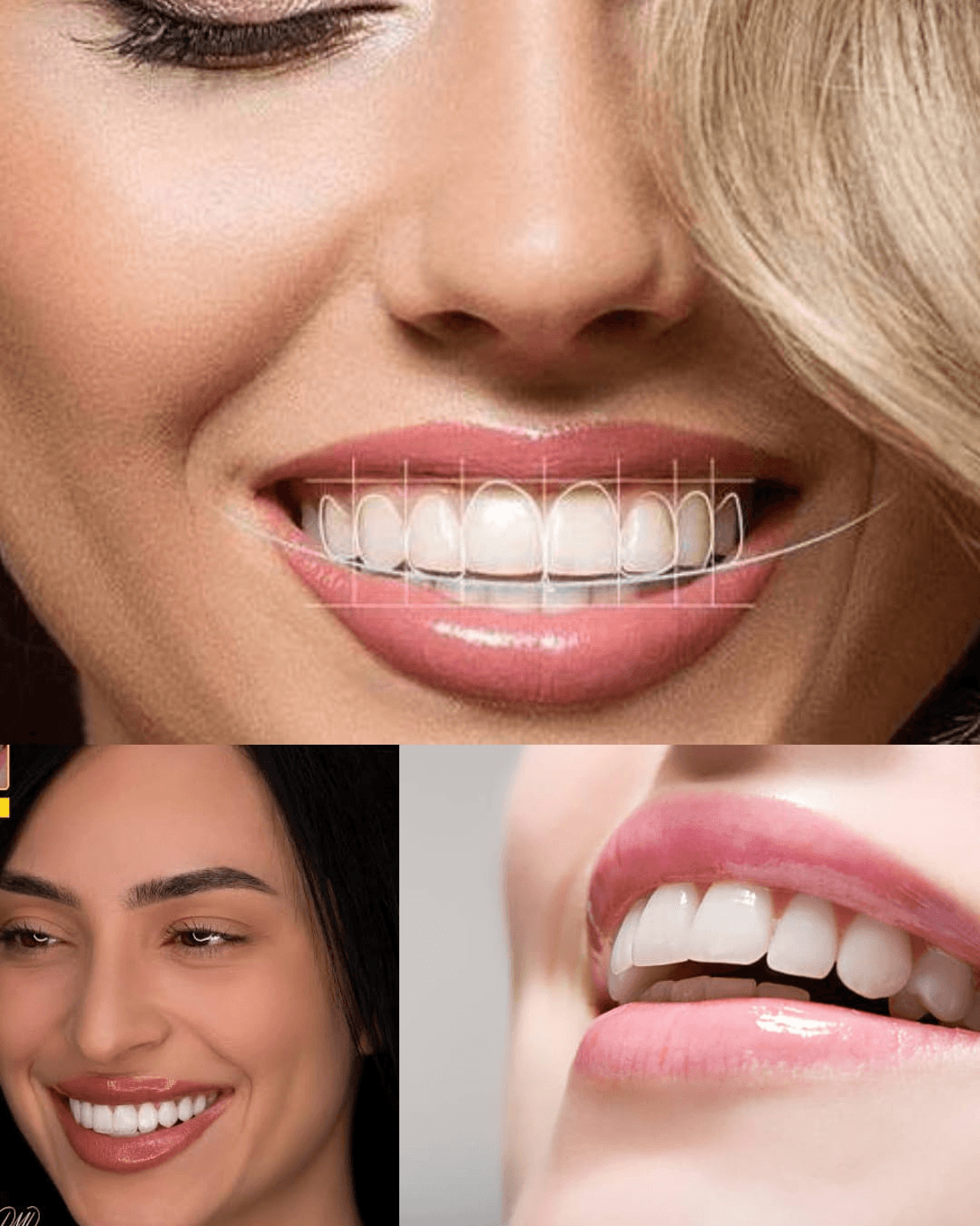 Dental Aesthetics And Smile Design