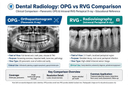 Dental X-ray ( OPG & RVG)